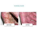 Intensive Skin Repair Ointment