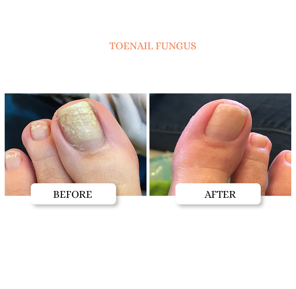 Clarifying Nail Ointment