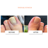 Clarifying Nail Ointment