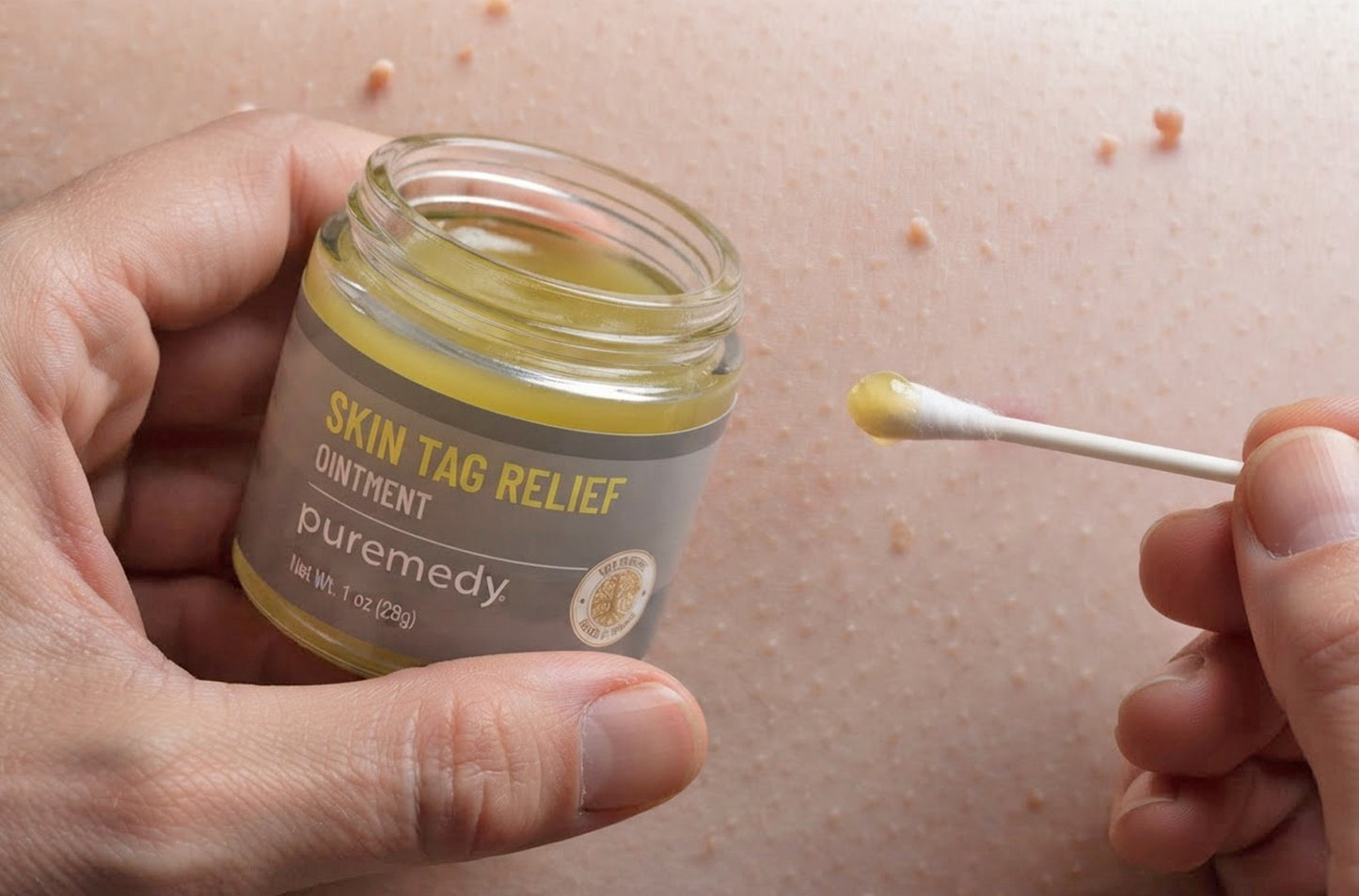 Skin Tag Relief