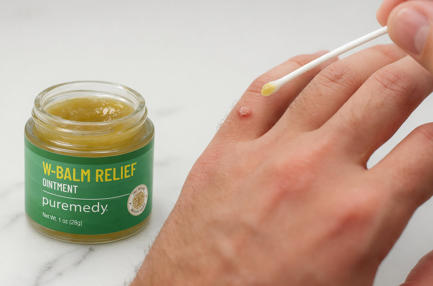 W-Relief