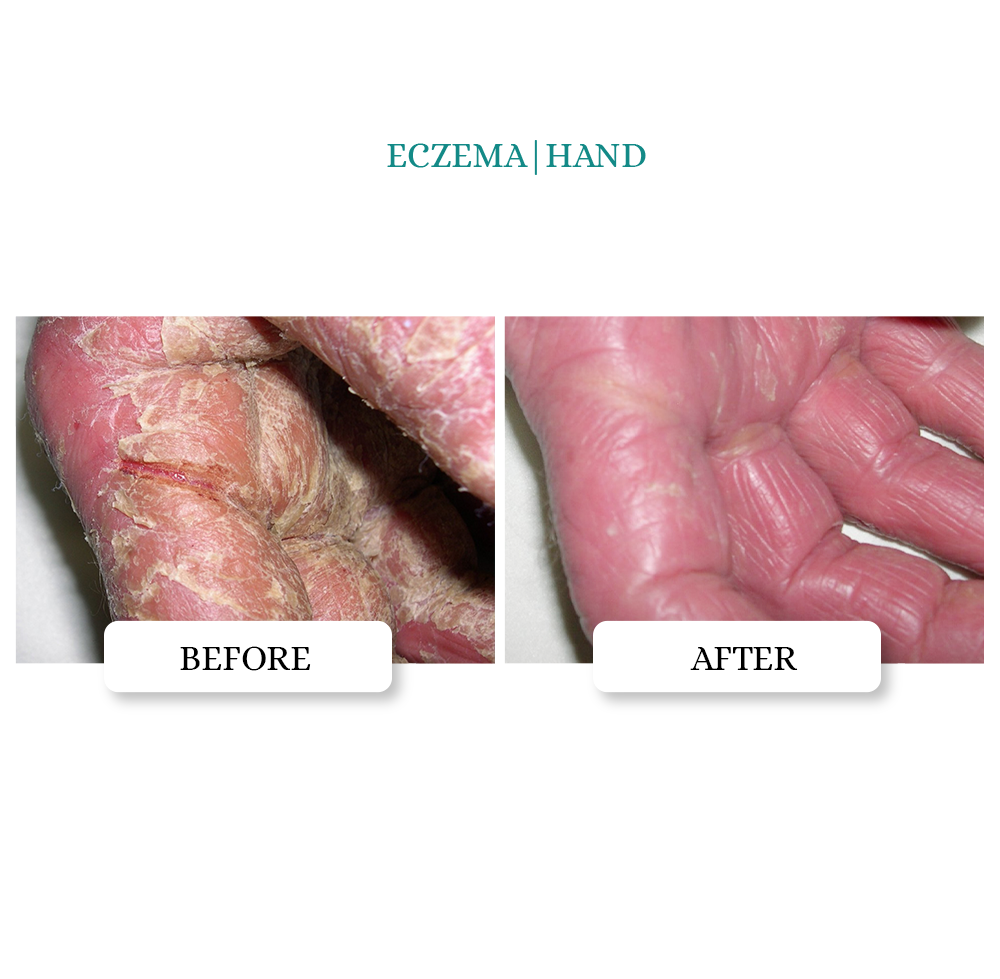 Intensive Skin Repair Ointment