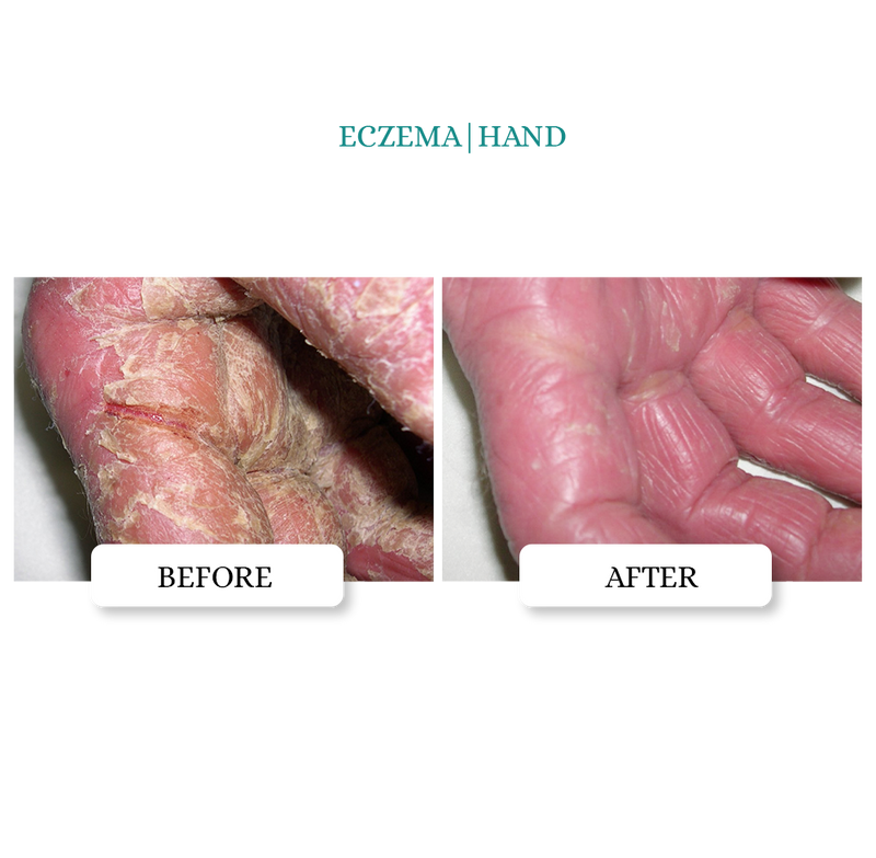 Intensive Skin Repair Ointment