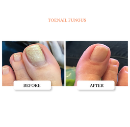 Clarifying Nail Ointment