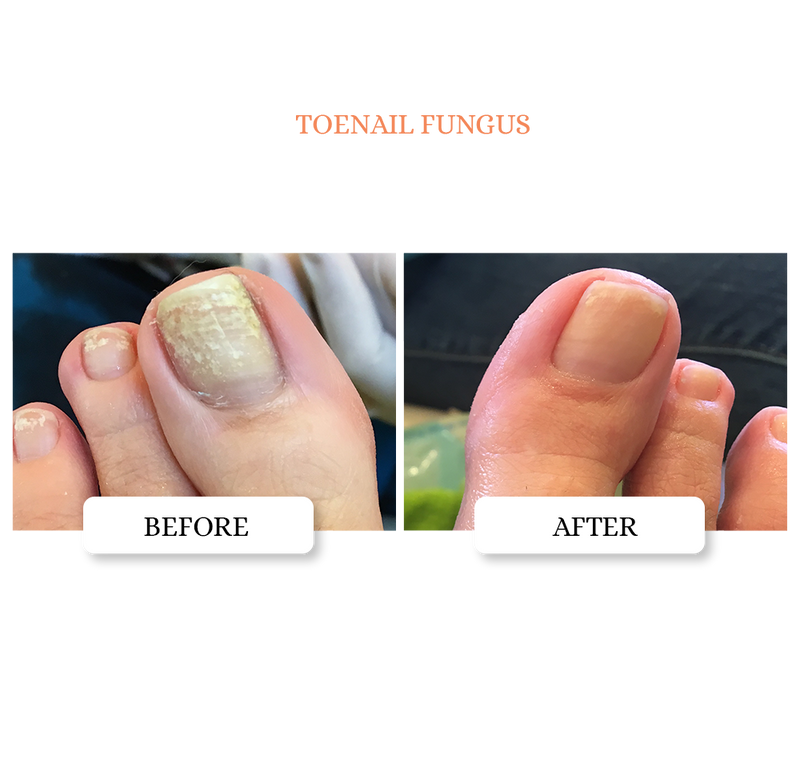 Clarifying Nail Ointment