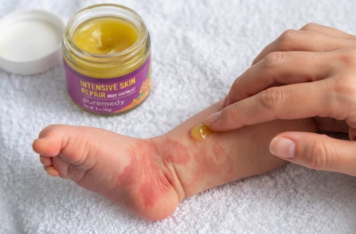 Intensive Skin Repair for babies