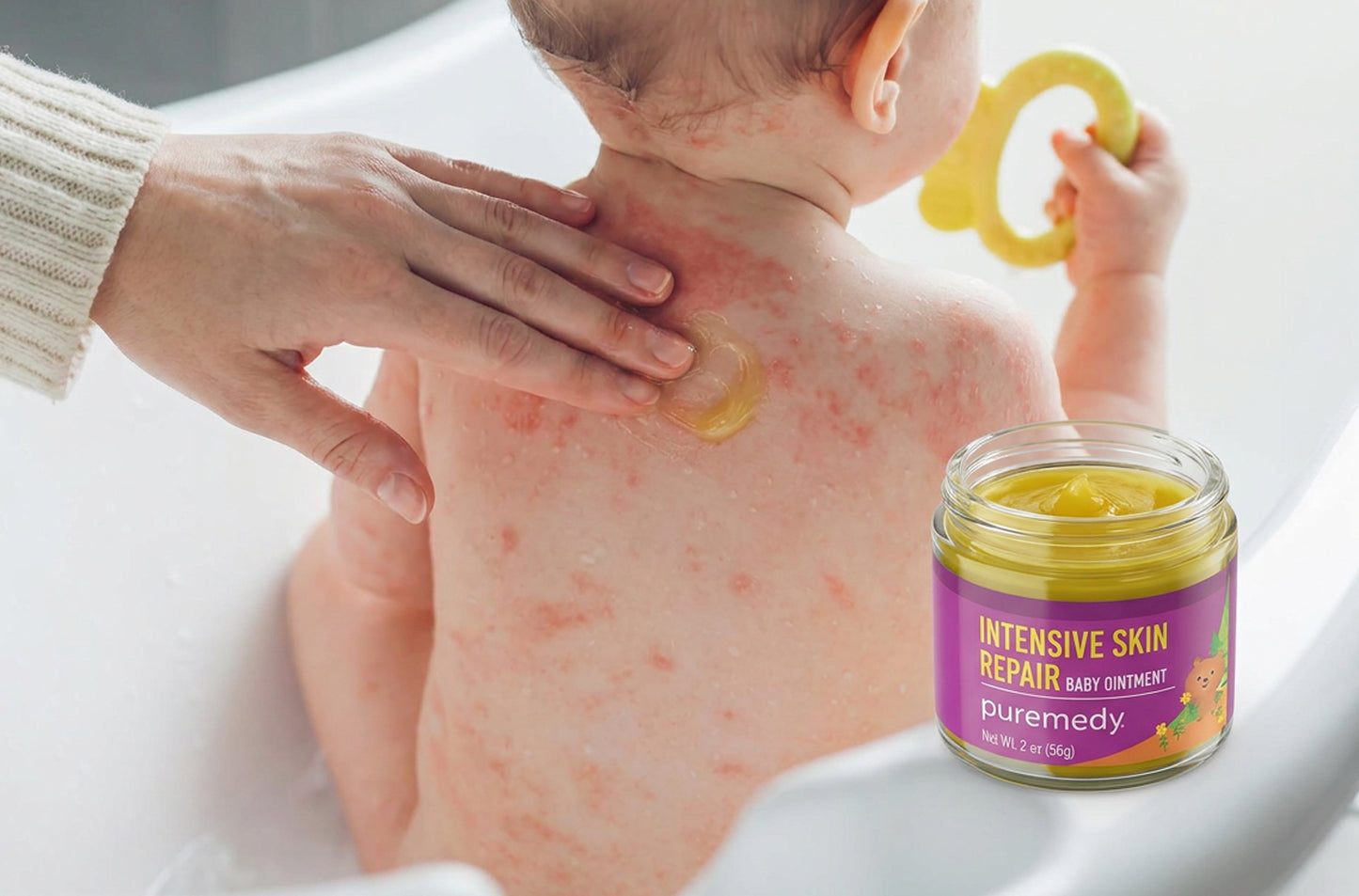 Intensive Skin Repair for babies