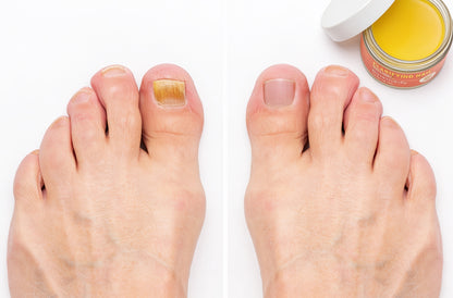 Clarifying Nail Ointment