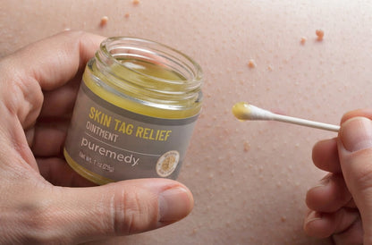 Skin Tag Relief